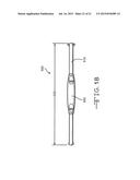 RETRACTOR TOOLS FOR MINIMALLY INVASIVE HIP SURGERY diagram and image