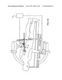 Robot Guided Oblique Spinal Stabilization diagram and image