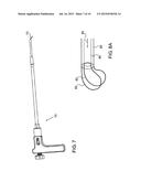 Robot Guided Oblique Spinal Stabilization diagram and image