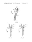 DEVICES AND METHODS FOR CORRECTING SPINAL DEFORMITIES diagram and image