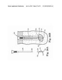 Fixation System for Orthopedic Devices diagram and image