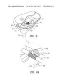 IMPACTOR AND REMOVER DEVICES diagram and image