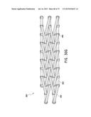 NEGATIVE PRESSURE WOUND CLOSURE DEVICE diagram and image