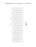 PASSIVATED METALLIC IMPLANTABLE MEDICAL DEVICES INCLUDING RADIOPAQUE     MARKERS diagram and image