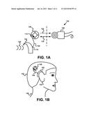 Hearing Prosthesis with a Standard Wire Interface diagram and image