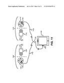 Hearing Prosthesis with a Standard Wire Interface diagram and image