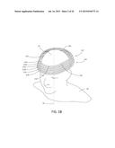 MAGNETIC STIMULATION COILS AND FERROMAGNETIC COMPONENTS FOR REDUCED     SURFACE STIMULATION AND IMPROVED TREATMENT DEPTH diagram and image