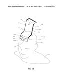 MAGNETIC STIMULATION COILS AND FERROMAGNETIC COMPONENTS FOR REDUCED     SURFACE STIMULATION AND IMPROVED TREATMENT DEPTH diagram and image