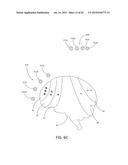 MAGNETIC STIMULATION COILS AND FERROMAGNETIC COMPONENTS FOR REDUCED     SURFACE STIMULATION AND IMPROVED TREATMENT DEPTH diagram and image