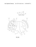 MAGNETIC STIMULATION COILS AND FERROMAGNETIC COMPONENTS FOR REDUCED     SURFACE STIMULATION AND IMPROVED TREATMENT DEPTH diagram and image