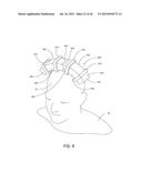 MAGNETIC STIMULATION COILS AND FERROMAGNETIC COMPONENTS FOR REDUCED     SURFACE STIMULATION AND IMPROVED TREATMENT DEPTH diagram and image