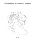 MAGNETIC STIMULATION COILS AND FERROMAGNETIC COMPONENTS FOR REDUCED     SURFACE STIMULATION AND IMPROVED TREATMENT DEPTH diagram and image