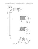 High Intensity Focused Ultrasound Catheter Apparatuses, Systems, and     Methods for Renal Neuromodulation diagram and image