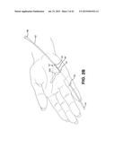 METHOD AND APPARATUS FOR REPAIRING A TENDON OR LIGAMENT diagram and image