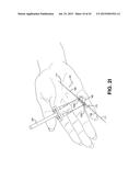 METHOD AND APPARATUS FOR REPAIRING A TENDON OR LIGAMENT diagram and image