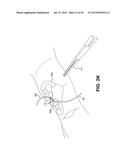 METHOD AND APPARATUS FOR REPAIRING A TENDON OR LIGAMENT diagram and image