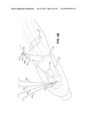 METHOD AND APPARATUS FOR REPAIRING A TENDON OR LIGAMENT diagram and image