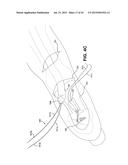 METHOD AND APPARATUS FOR REPAIRING A TENDON OR LIGAMENT diagram and image