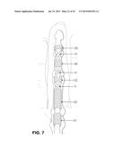 METHOD AND APPARATUS FOR REPAIRING A TENDON OR LIGAMENT diagram and image