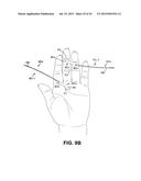 METHOD AND APPARATUS FOR REPAIRING A TENDON OR LIGAMENT diagram and image