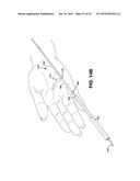 METHOD AND APPARATUS FOR REPAIRING A TENDON OR LIGAMENT diagram and image