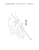 METHOD AND APPARATUS FOR REPAIRING A TENDON OR LIGAMENT diagram and image