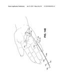 METHOD AND APPARATUS FOR REPAIRING A TENDON OR LIGAMENT diagram and image