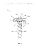 SPINAL STABILIZATION SYSTEM diagram and image