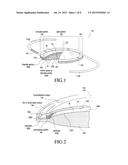 INTRAOCULAR LENS SYSTEM AND METHOD FOR POWER ADJUSTMENT diagram and image