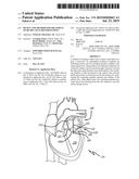 DEVICE AND METHOD FOR TREATMENT OF HEART VALVE REGURGITATION diagram and image