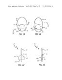 DEVICE AND METHOD FOR TREATMENT OF HEART VALVE REGURGITATION diagram and image