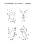 DEVICE AND METHOD FOR TREATMENT OF HEART VALVE REGURGITATION diagram and image