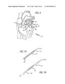 DEVICE AND METHOD FOR TREATMENT OF HEART VALVE REGURGITATION diagram and image