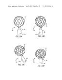 DEVICE AND METHOD FOR TREATMENT OF HEART VALVE REGURGITATION diagram and image