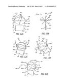 DEVICE AND METHOD FOR TREATMENT OF HEART VALVE REGURGITATION diagram and image