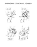 DEVICE AND METHOD FOR TREATMENT OF HEART VALVE REGURGITATION diagram and image