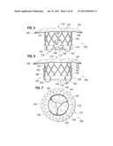 PROSTHETIC VALVE FOR REPLACING MITRAL VALVE diagram and image