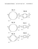 PROSTHETIC VALVE FOR REPLACING MITRAL VALVE diagram and image