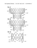 PROSTHETIC VALVE FOR REPLACING MITRAL VALVE diagram and image