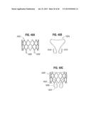 PROSTHETIC VALVE FOR REPLACING MITRAL VALVE diagram and image