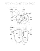 PROSTHETIC VALVE FOR REPLACING MITRAL VALVE diagram and image