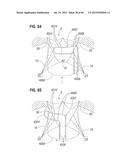 PROSTHETIC VALVE FOR REPLACING MITRAL VALVE diagram and image