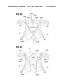 PROSTHETIC VALVE FOR REPLACING MITRAL VALVE diagram and image