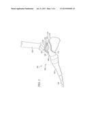 System and Method for Ankle Arthroplasty diagram and image