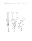 System and Method for Ankle Arthroplasty diagram and image