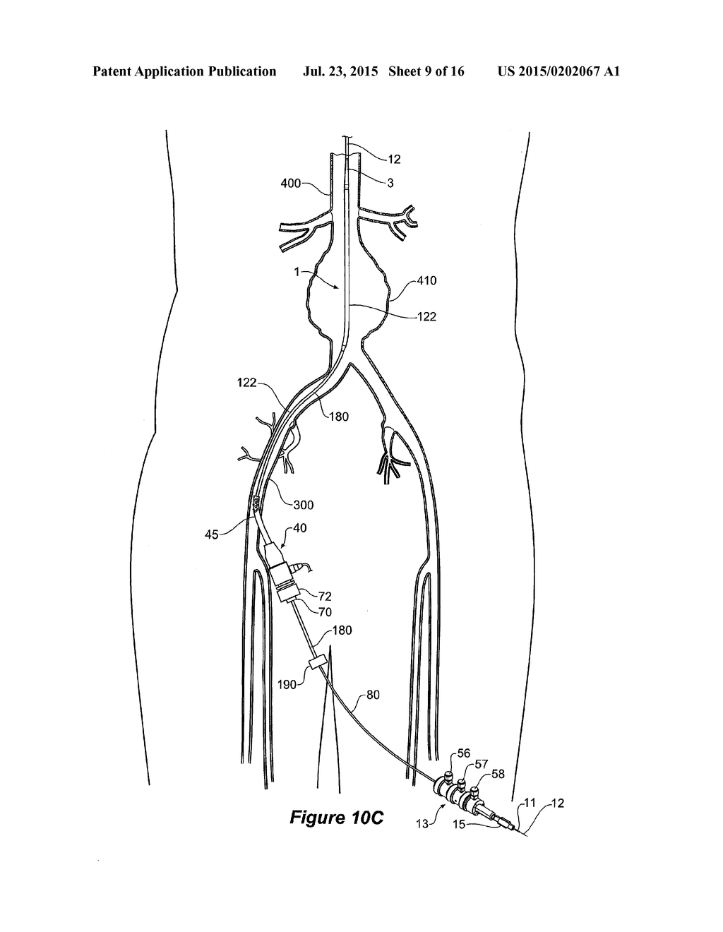 DELIVERY DEVICE FOR AN INSERTABLE MEDICAL DEVICE - diagram, schematic, and image 10