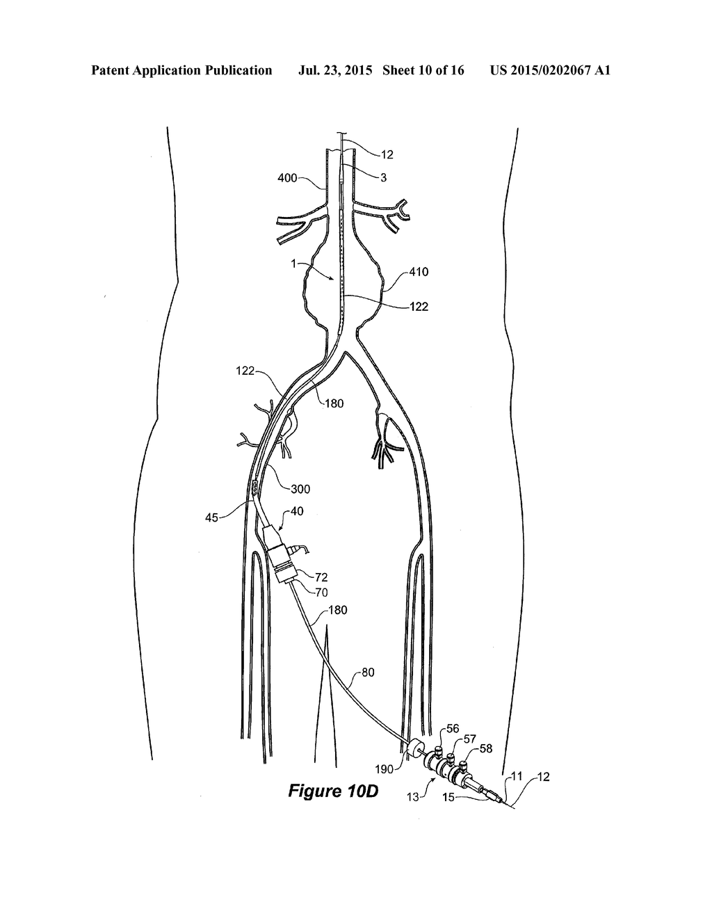 DELIVERY DEVICE FOR AN INSERTABLE MEDICAL DEVICE - diagram, schematic, and image 11