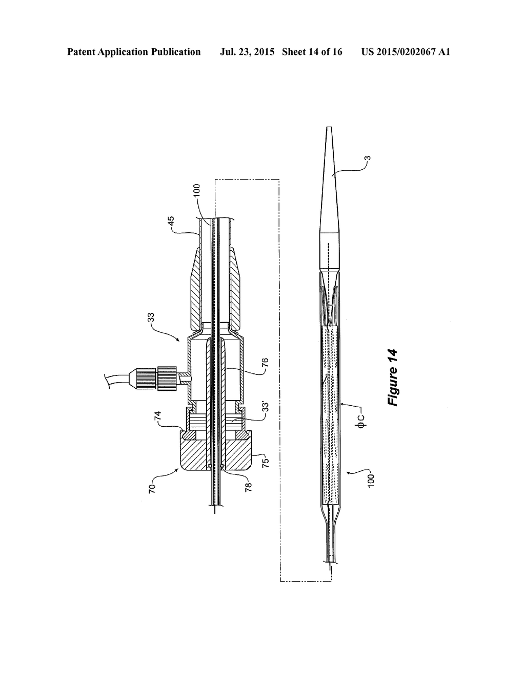 DELIVERY DEVICE FOR AN INSERTABLE MEDICAL DEVICE - diagram, schematic, and image 15