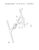 Absorbent Article diagram and image