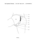 Absorbent Article diagram and image